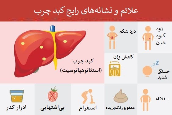 علائم و نشانه های کبدچرب