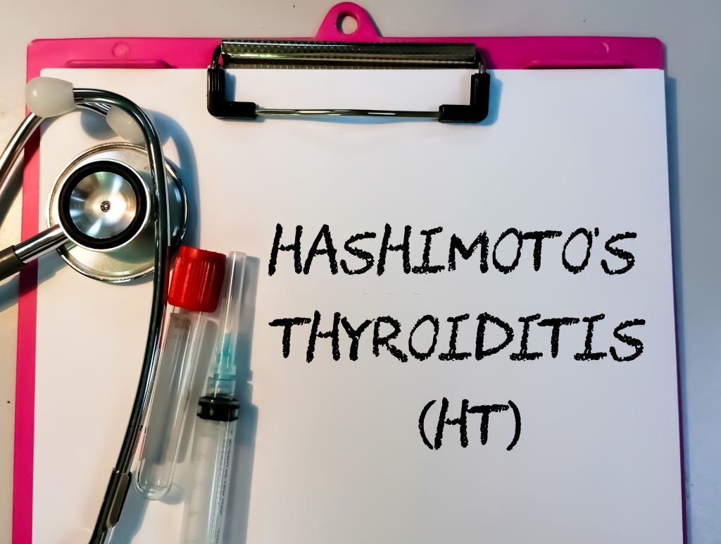 تیروئیدیت هاشیماتو چیست و چگونه درمان می شود؟ | مدینیوم