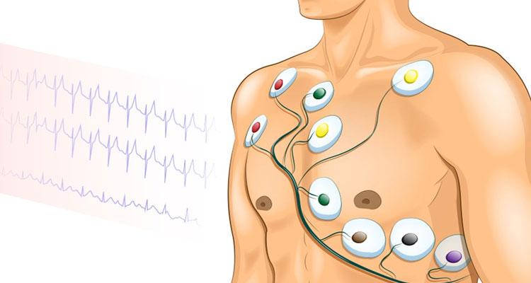 آموزش نحوه گرفتن نوار قلب با دستگاه ecg | مدینیوم